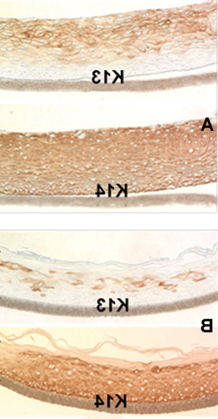 图1:细胞角蛋白K13和K14的免疫染色:A)口腔上皮组织和B)表皮上皮组织.